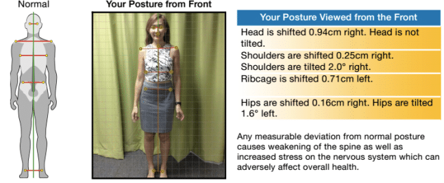 posture-problem